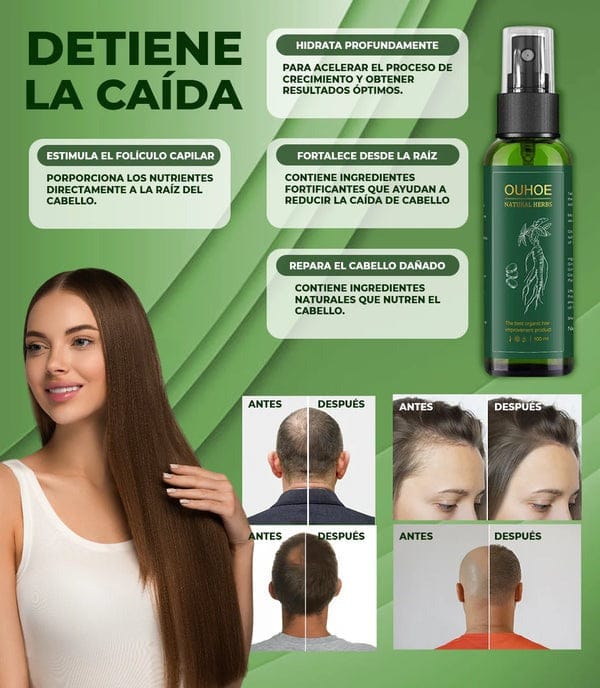 ¡Haz crecer tu cabello en 14 días! – ¡Compra 1 y recibe 2